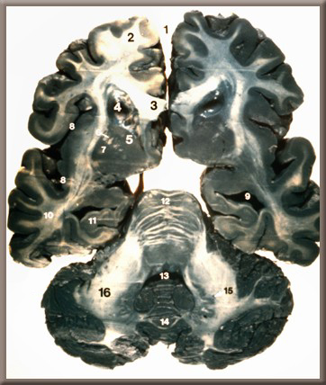 slide 28 image