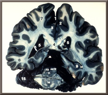 slide 40 image