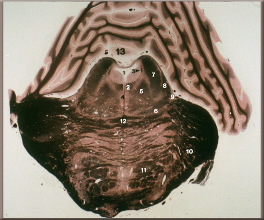 slide 56 iamge