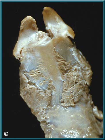 Larynx Part 1 - Slide 29
