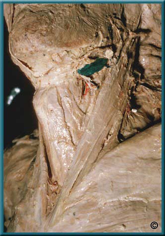 Slide 7 - Larynx Part 1