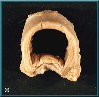 Larynx Part 1 - Slide 19