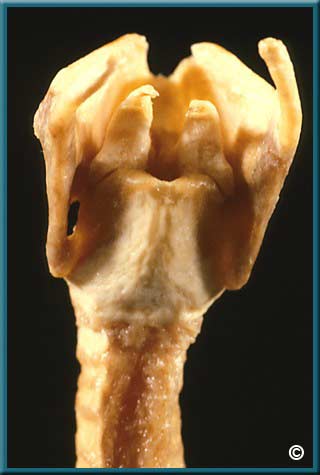 Larynx Part 1 - Slide 42