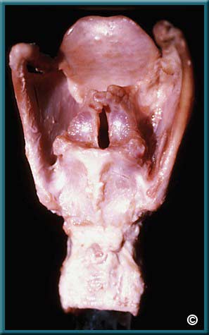 Larynx Part 1 - Slide 45