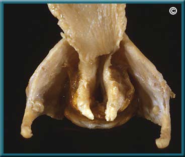 Larynx Part 1 - Slide 54