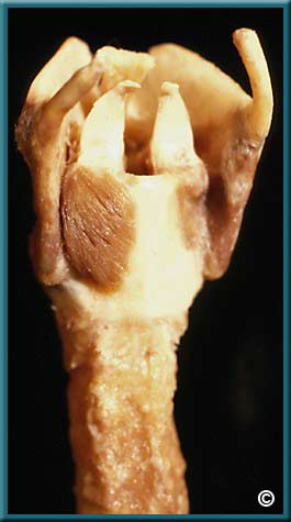 Larynx Part 1 - Slide 61