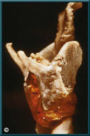 Larynx 2 - slide 1