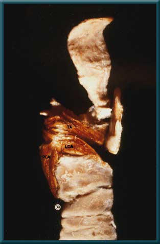 Larynx 2 - slide 2