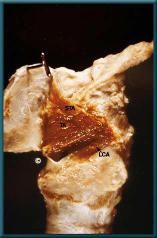 Larynx 2 - Slide 3