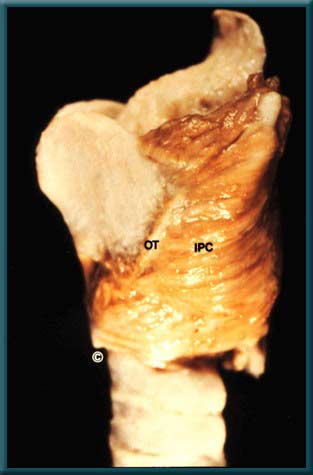 Larynx 2 - Slide 7