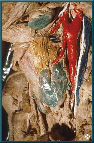 Larynx 2 - Slide 12