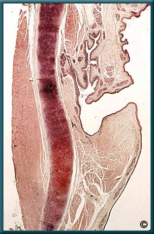 Larynx 2 - Slide 19